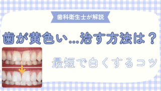 歯が黄色い…どう治す？歯科衛生士が「最短で白くするコツ」を解説